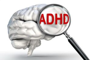 ADHD_Brain_MagnifyingGlass_AdobeStock_SMALL_95104500-300x199
